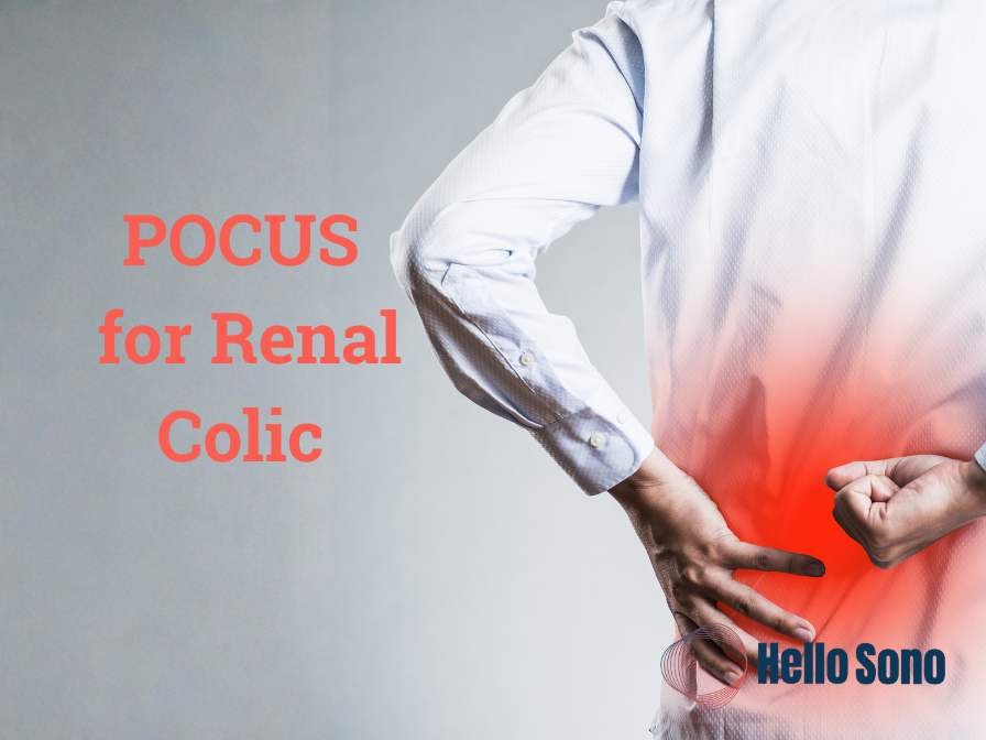 Do You Need a CT? POCUS in First-Time Renal Colic
