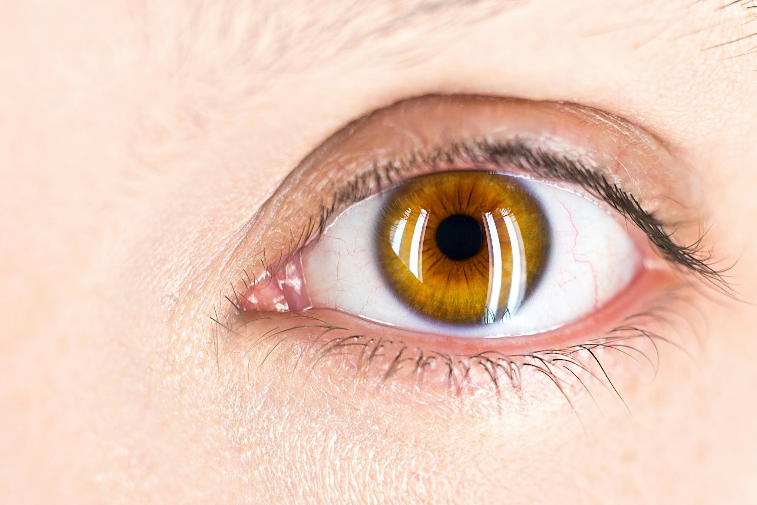 New Floaters After Minor Eye Trauma: Ocular POCUS When Fundoscopy Is Limited