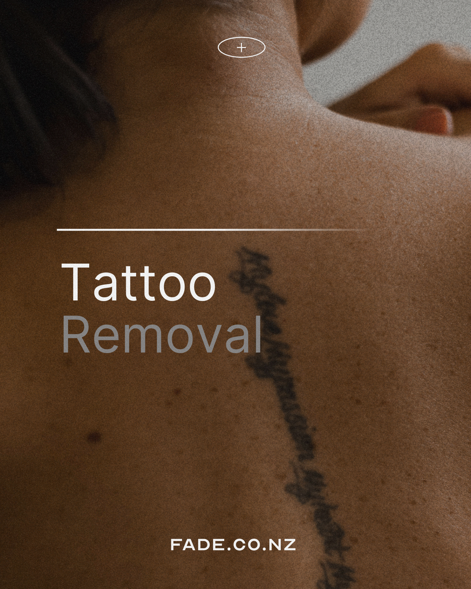 Tattoo Removal.png