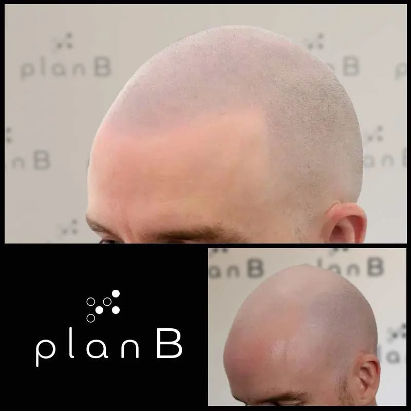 Plan_B_effet_rase14.jpg