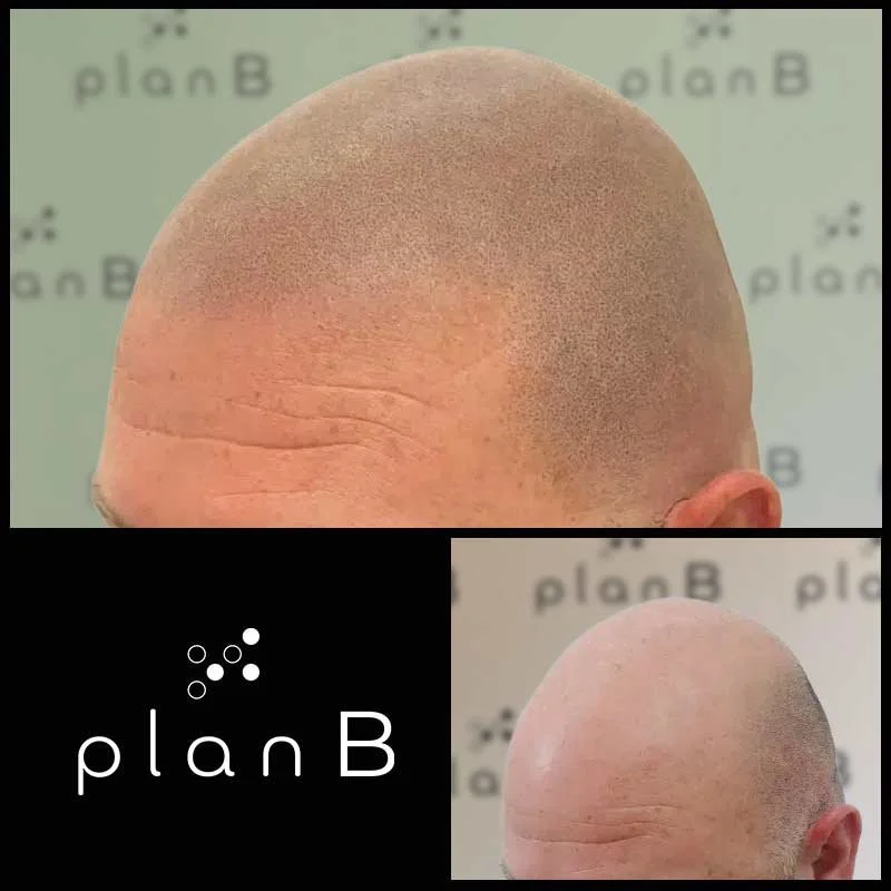 Plan_B_effet_rase19.jpg