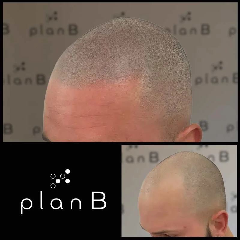 Plan_B_effet_rase5.jpg
