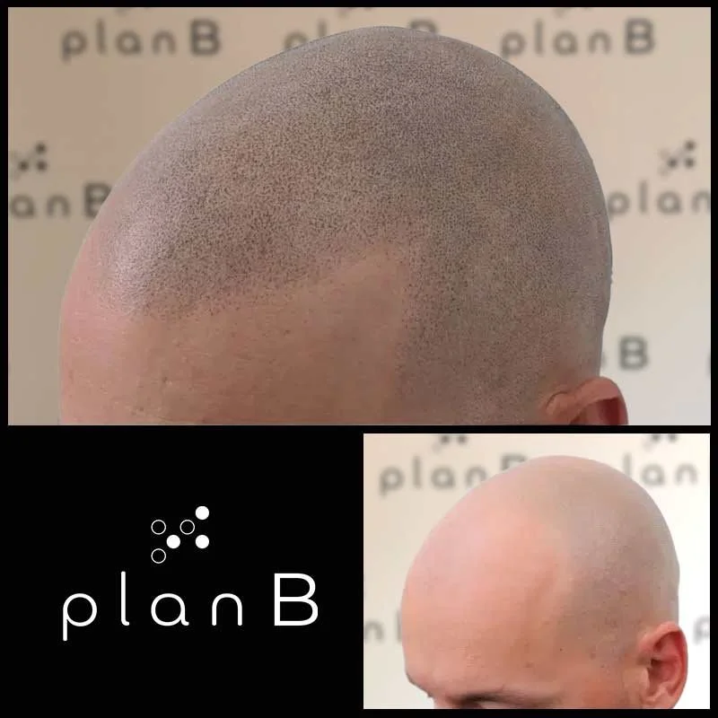 Plan_B_effet_rase1.jpg