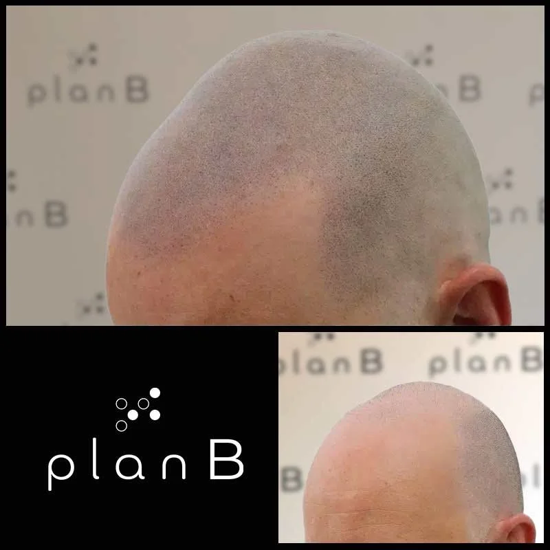 Plan_B_effet_rase10.jpg