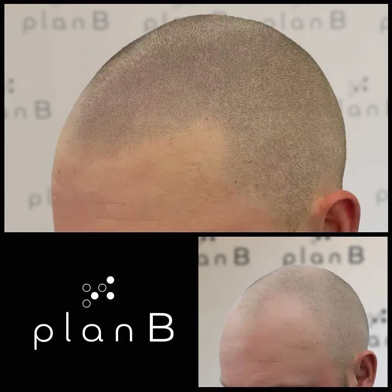 Plan_B_effet_rase18.jpg