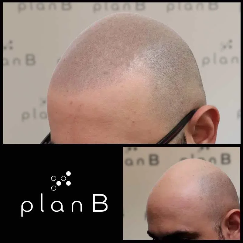 Plan_B_effet_rase16.jpg