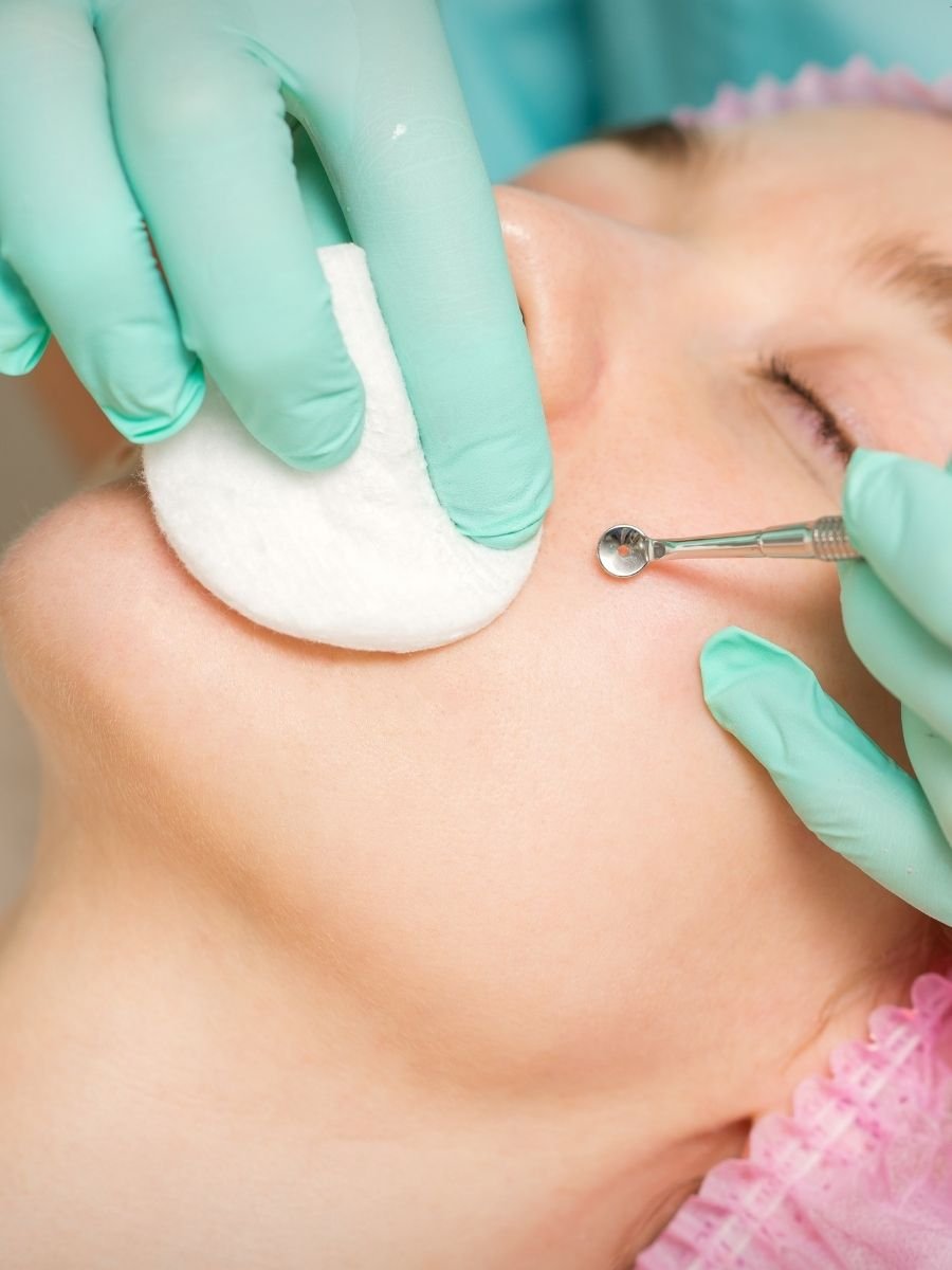 Facials for Blackheads