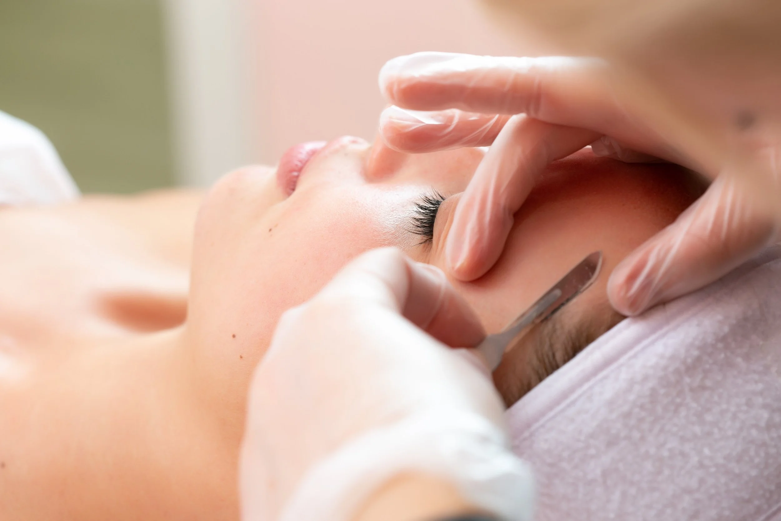 Professional Dermaplaning treatment at Lakeside Skin & Laser, the best in the Okanagan, for smooth, radiant skin