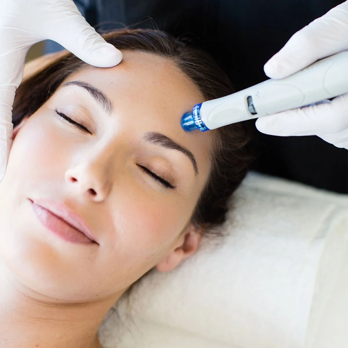 hydrafacial-treatment at Lakeside Skin and Laser in Penticton