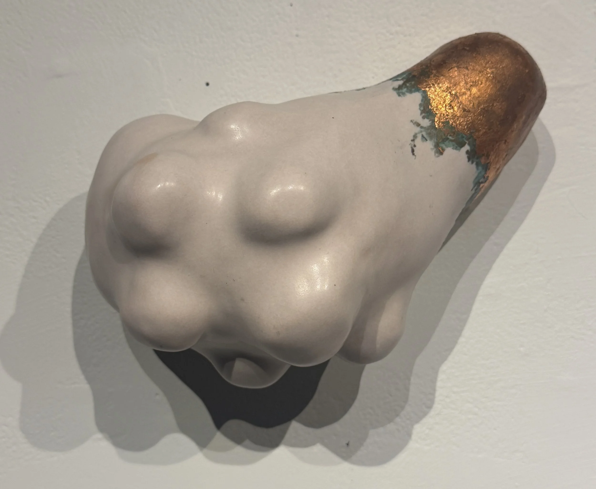 Polycystic Ovary | 2026 | Stoneware, copper