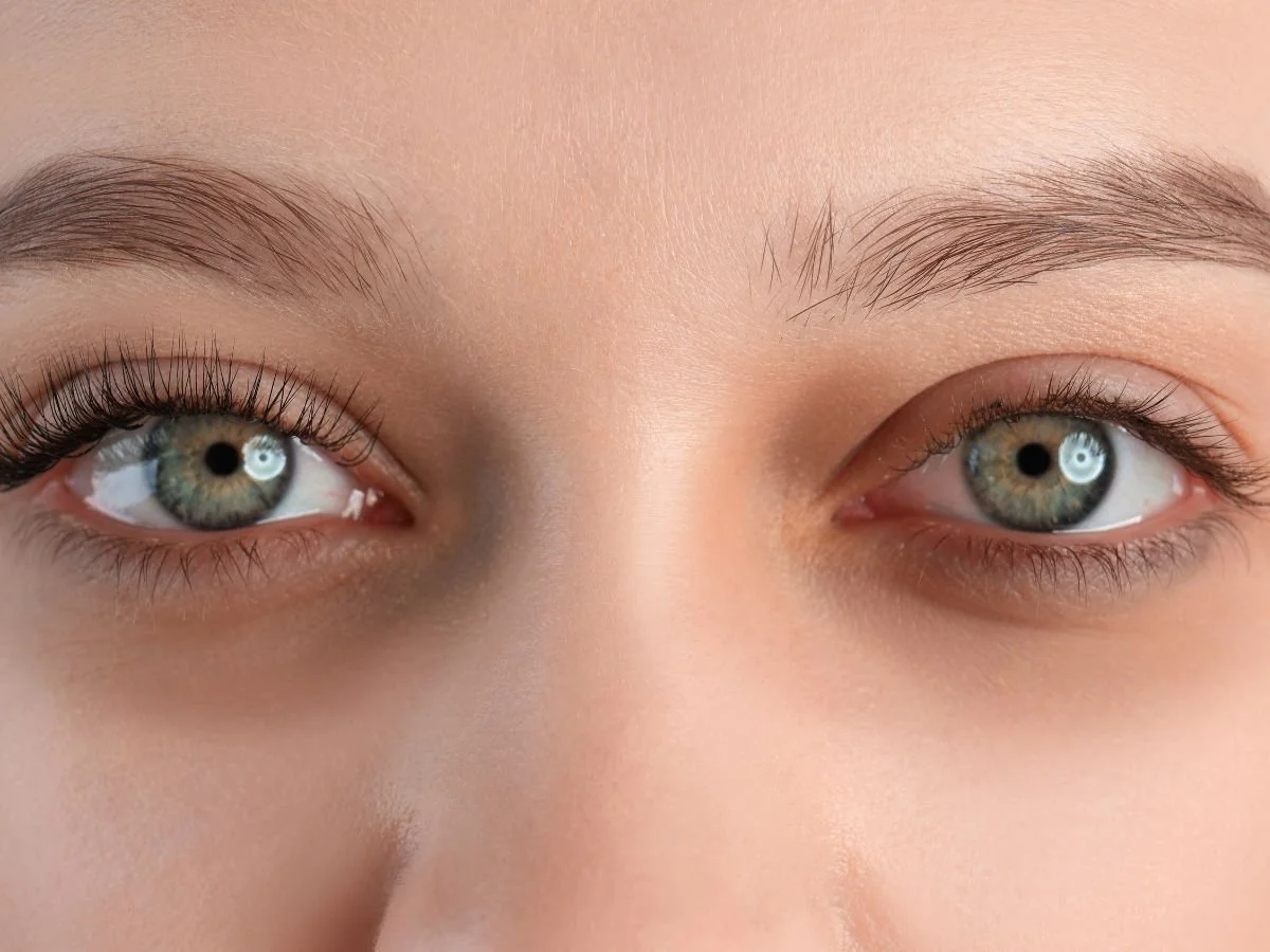Why Under-Eye Bags Are Such a Challenge