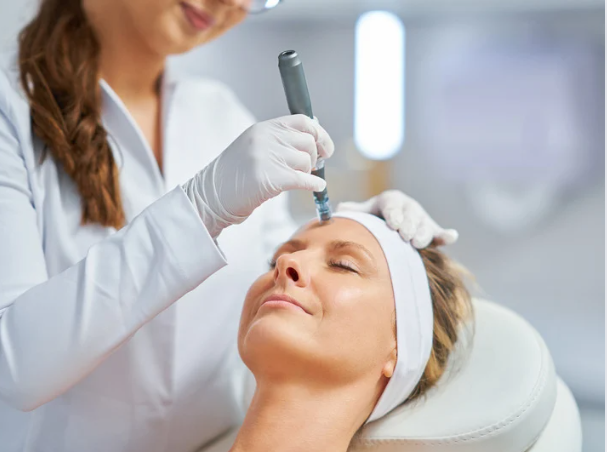 Microneedling PRP Before and After: What to Expect