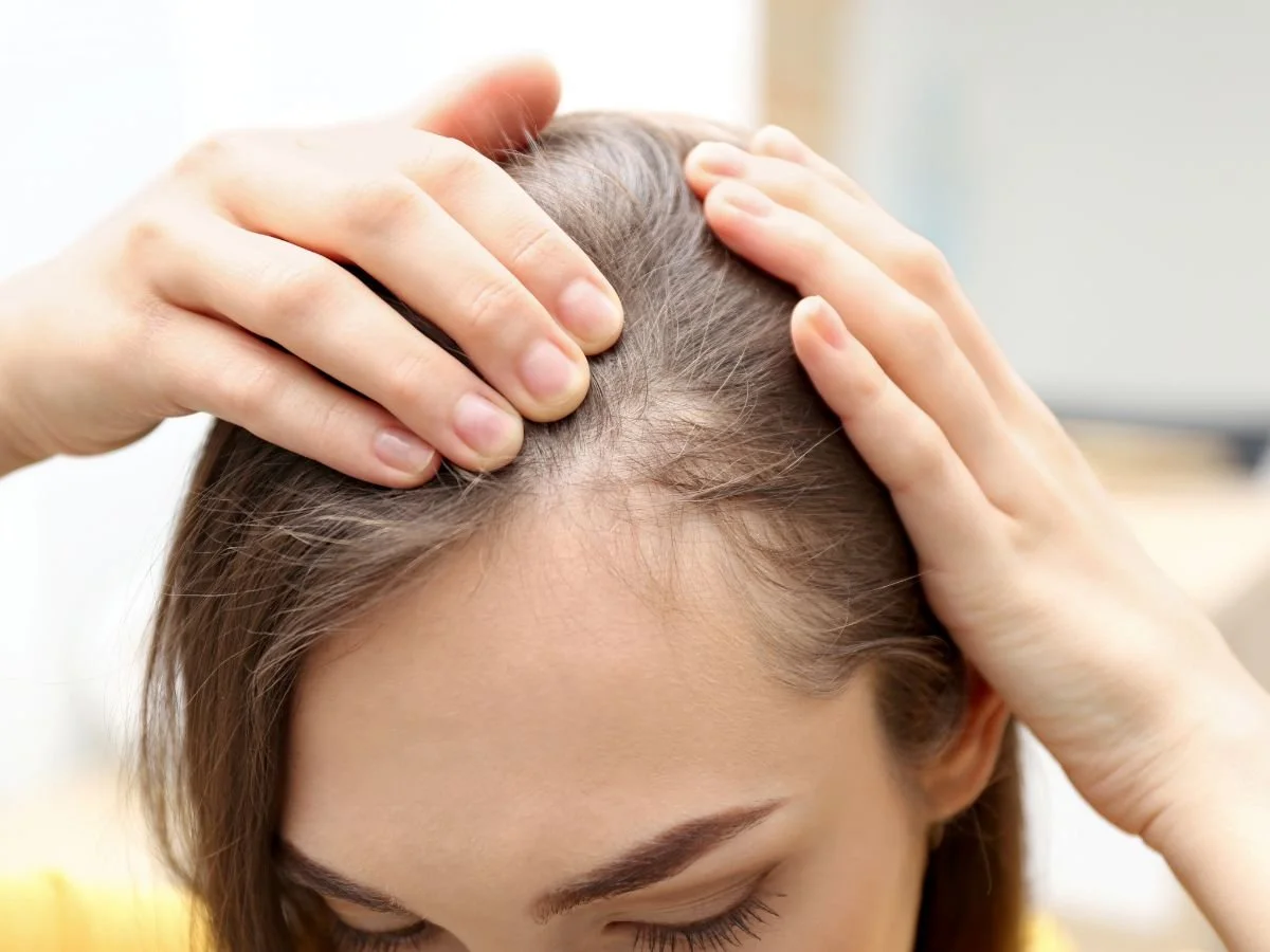How Much Does PRP Hair Restoration Cost in Miami