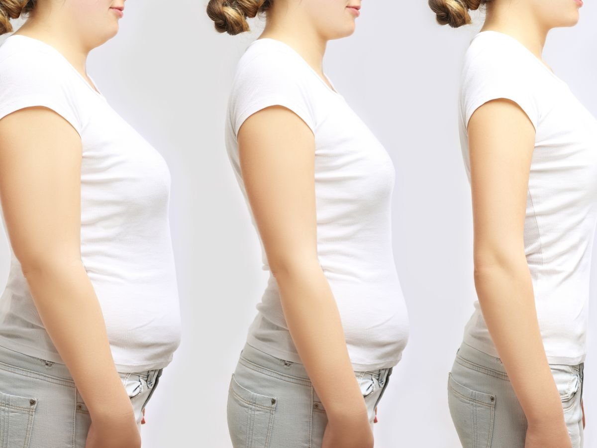 Mesotherapy in Miami