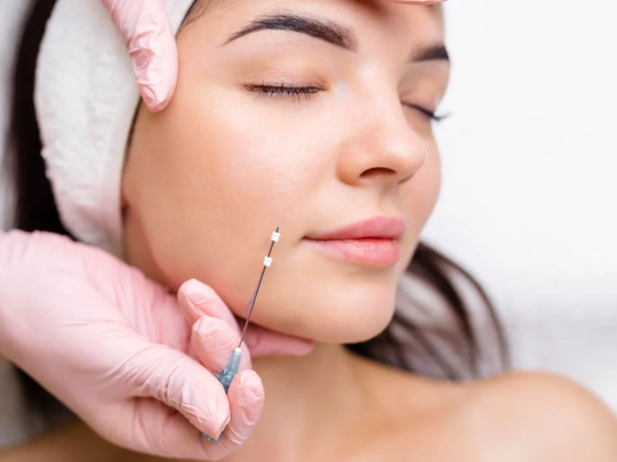 Endolift vs PDO Thread Lift Cost in Miami