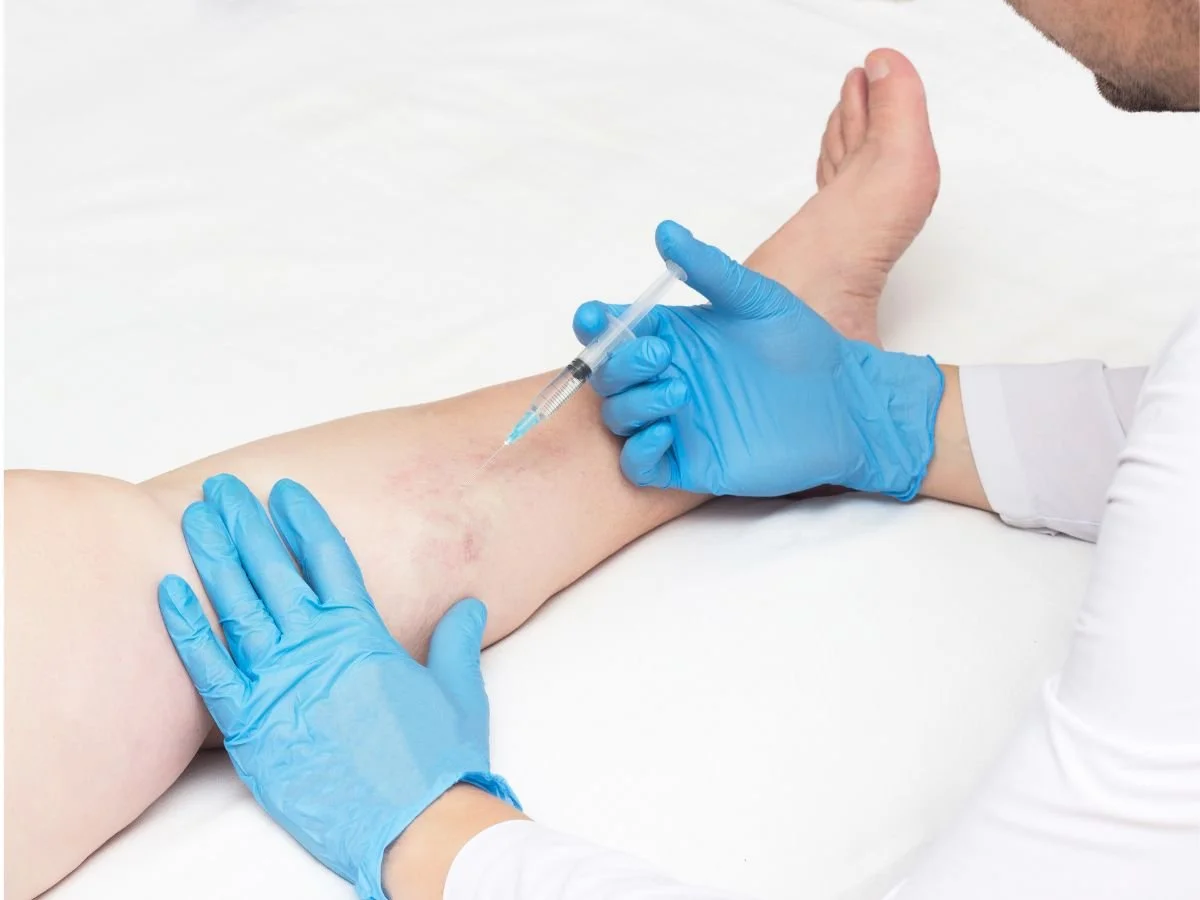 Can Older Adults Get Sclerotherapy Safely?