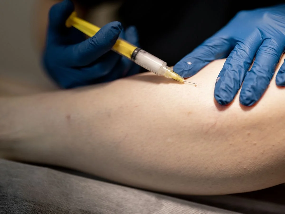 Foam vs Liquid Sclerotherapy, Which Is Better for Veins.jpg