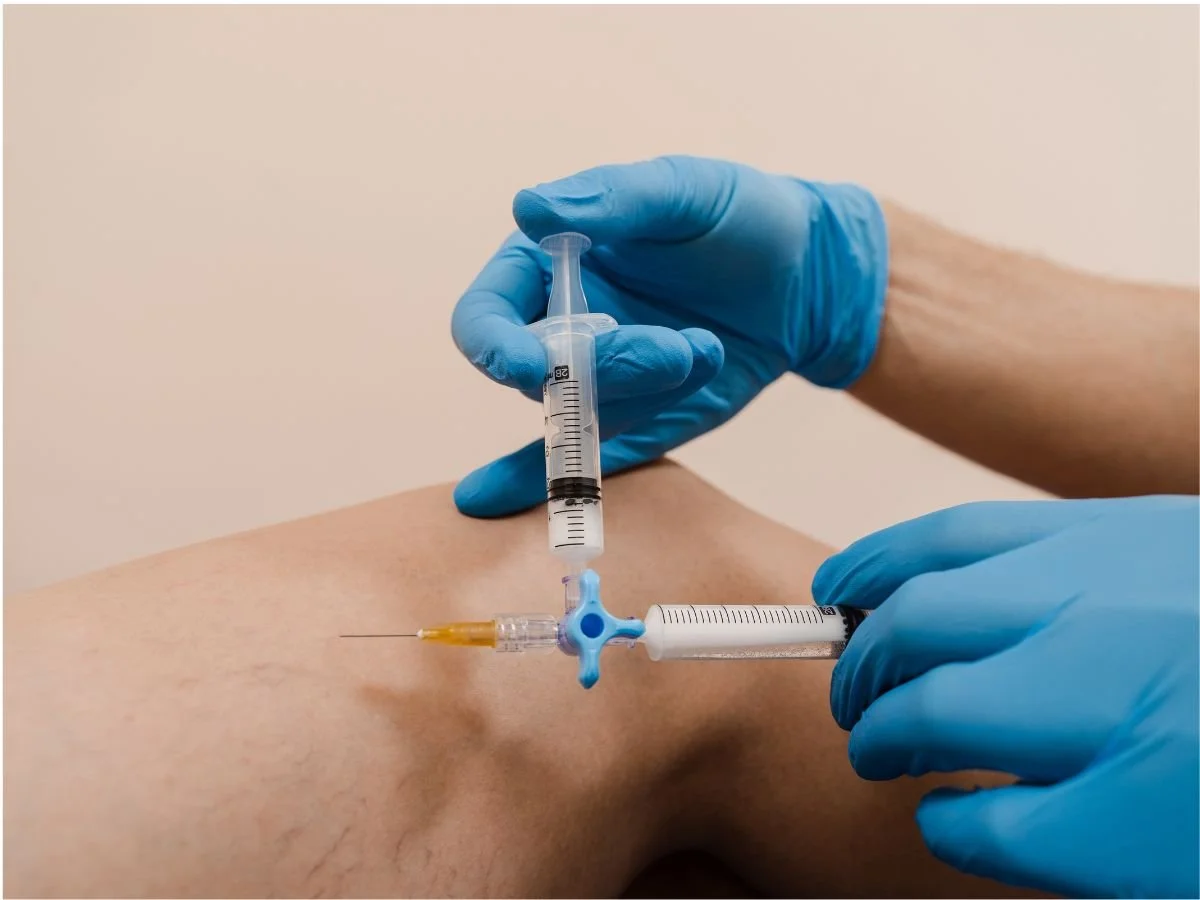 Cosmetic vs. Medical Vein Treatment, What’s the Difference