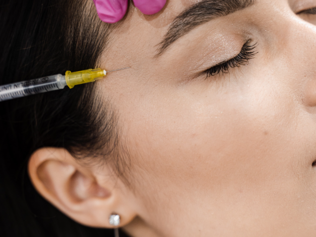 How Do Sculptra and Radiesse Differ in Their Mechanism