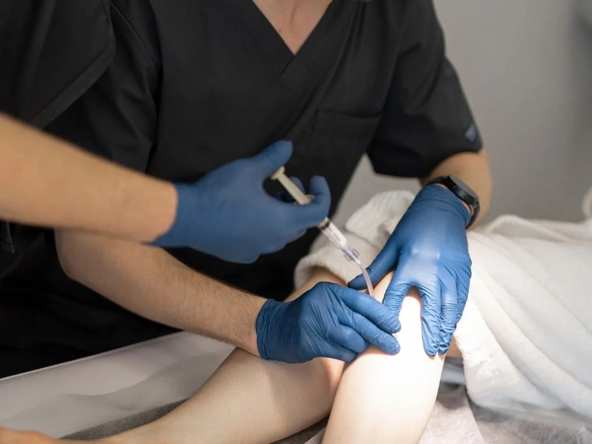 Can a Lump After Sclerotherapy Be Treated?