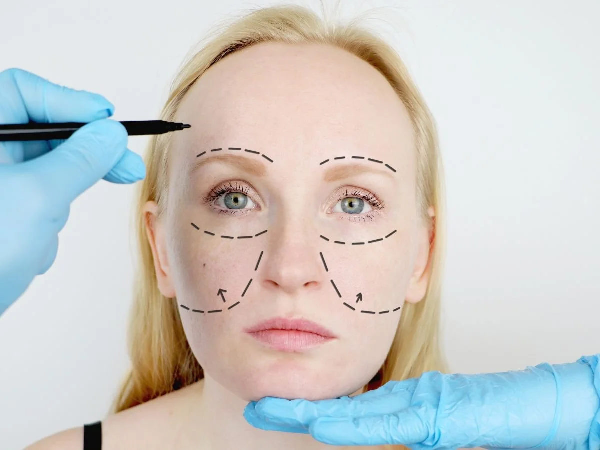 WHAT IS A NON-SURGICAL FACELIFT