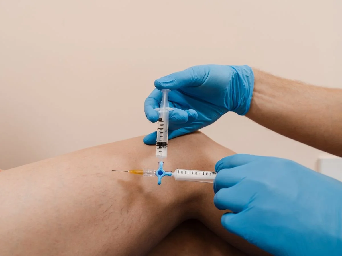 Why Spider Veins Become More Common as We Age