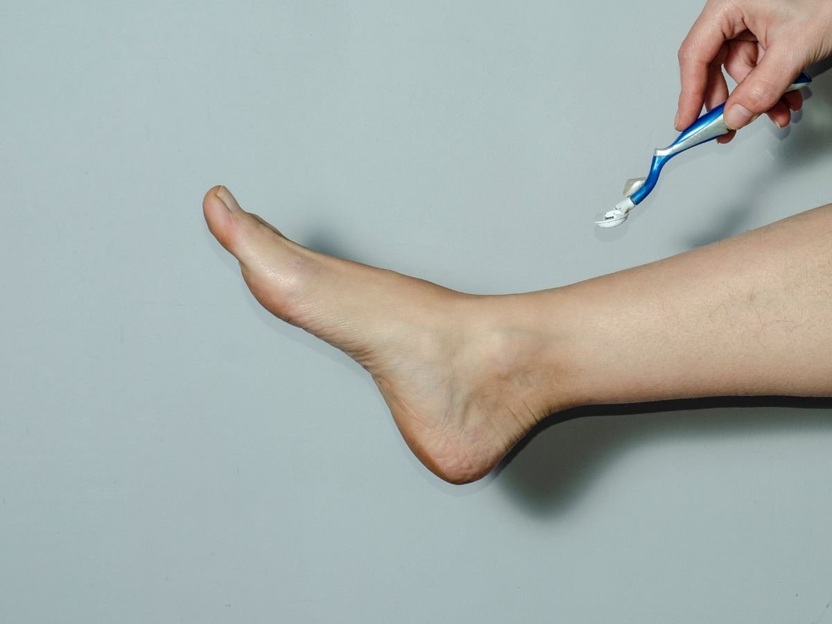 Hair Removal After Sclerotherapy, What's Safe and What's Not