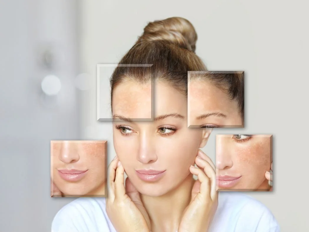 What Exactly Is EndoLift