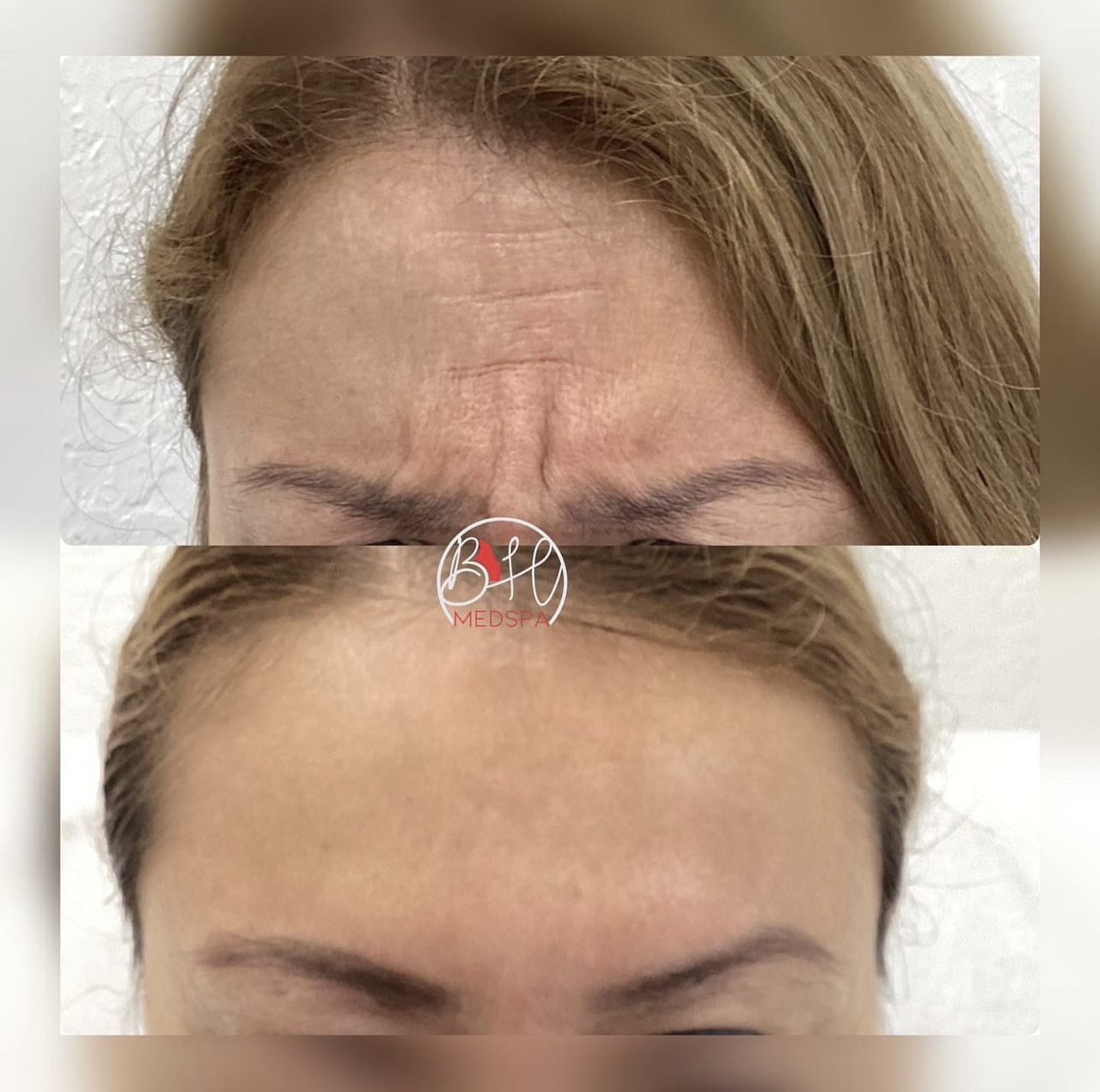 Top Med Spa Treatments Near Me in Miami, FL