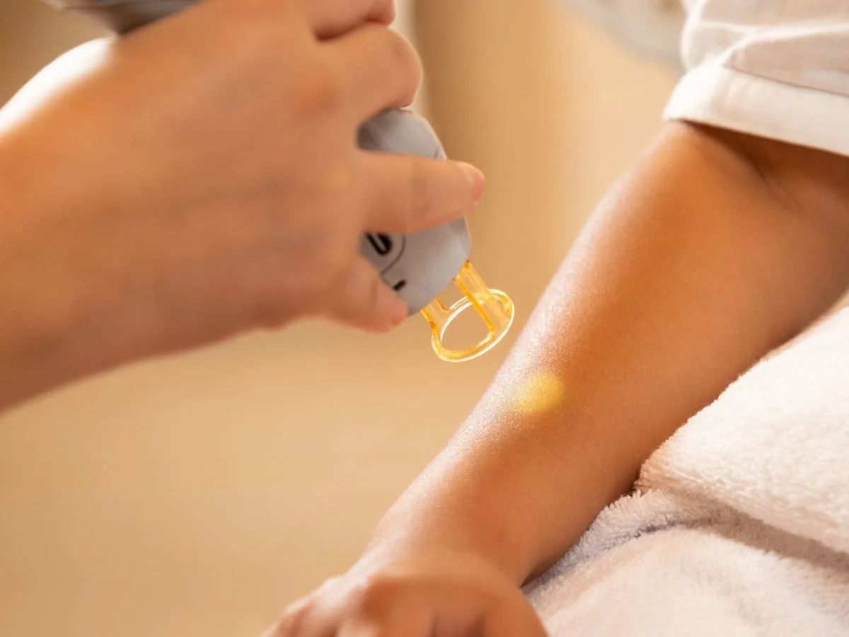 Benefits of Laser Hair Removal