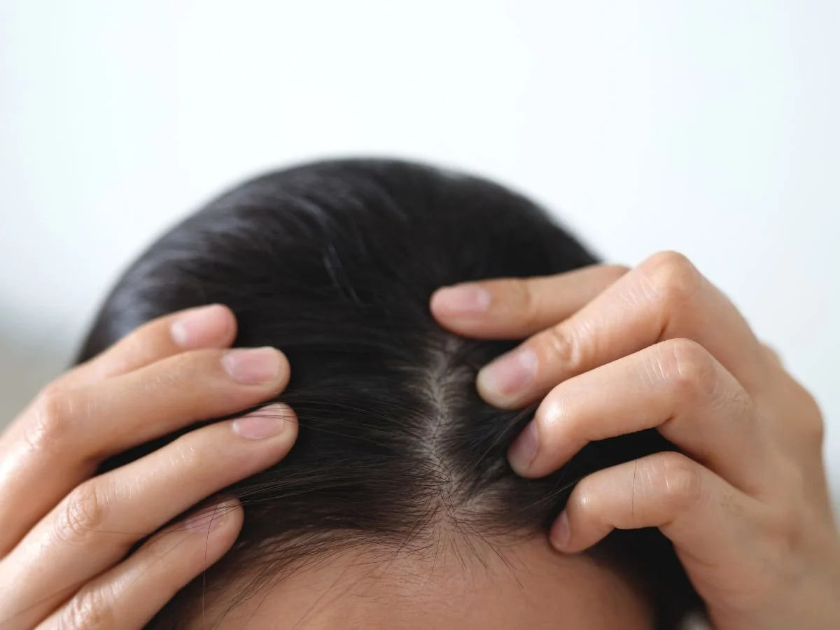 PRP Therapy in Miami, ADVANCED HAIR LOSS TREATMENTS AT BEYOND HEALTH MEDSPA