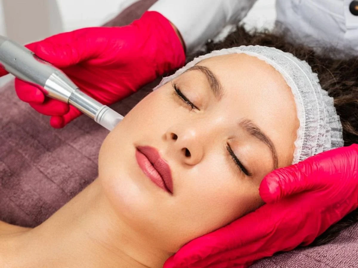Number of Microneedling PRP sessions