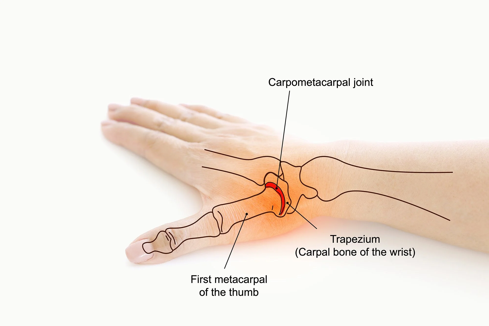 Pain Swelling Or Decreased Strength In Your Thumb Learn About Thumb 
