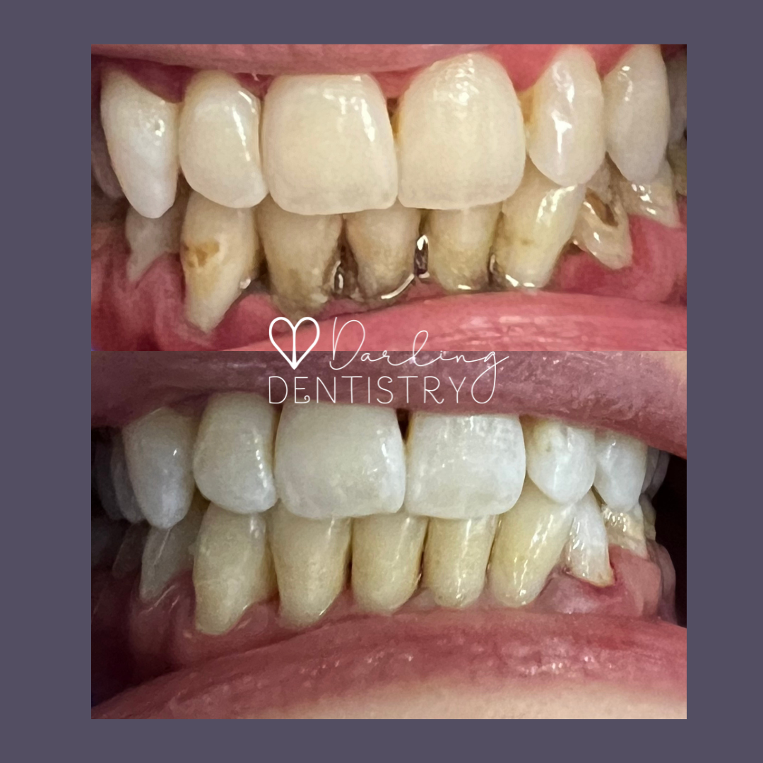 Transformations Gallery Darling Dentistry transformations-gallery-darling-dentistry