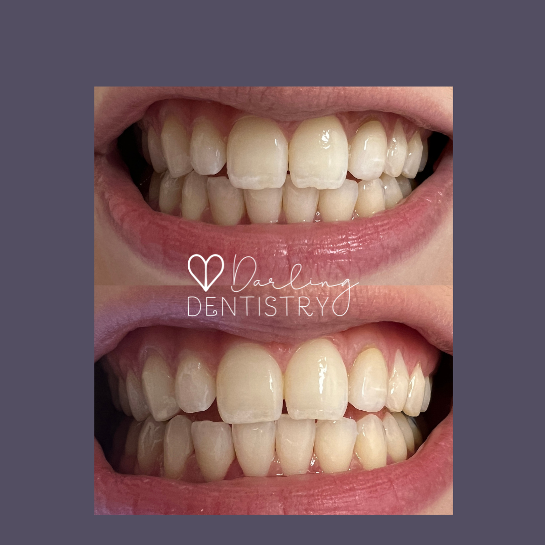 Transformations Gallery Darling Dentistry transformations-gallery-darling-dentistry