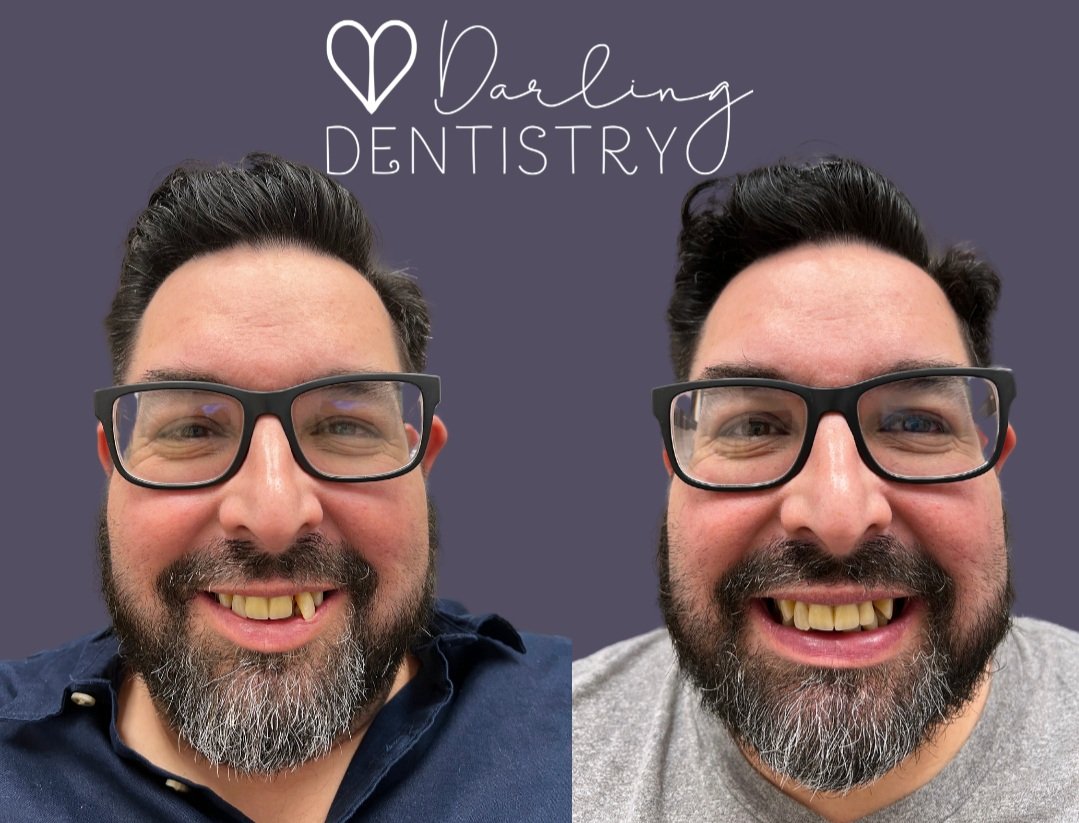 Transformations Gallery Darling Dentistry transformations-gallery-darling-dentistry