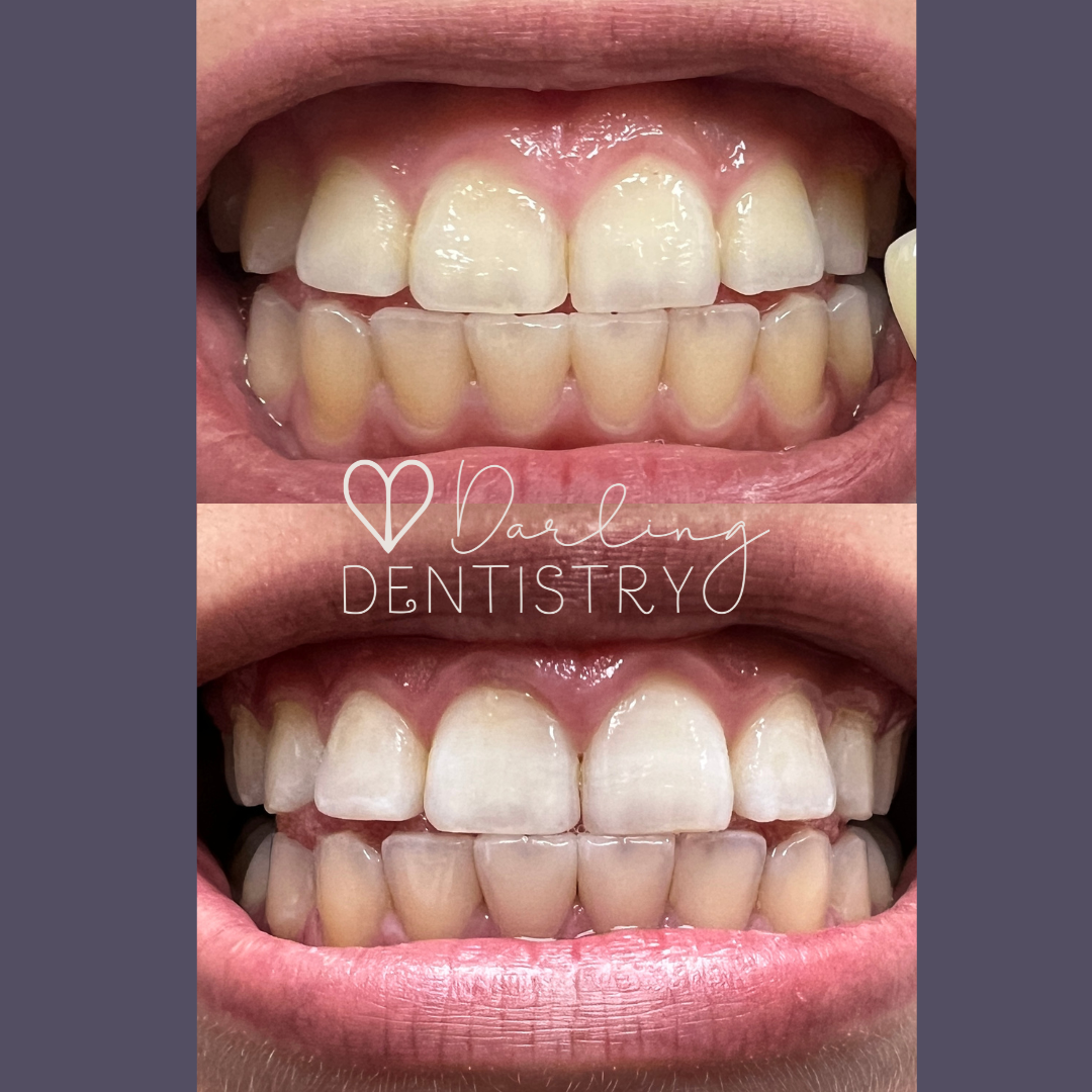 Transformations Gallery Darling Dentistry transformations-gallery-darling-dentistry