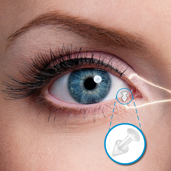 dry eye punctum plugs at eye academy