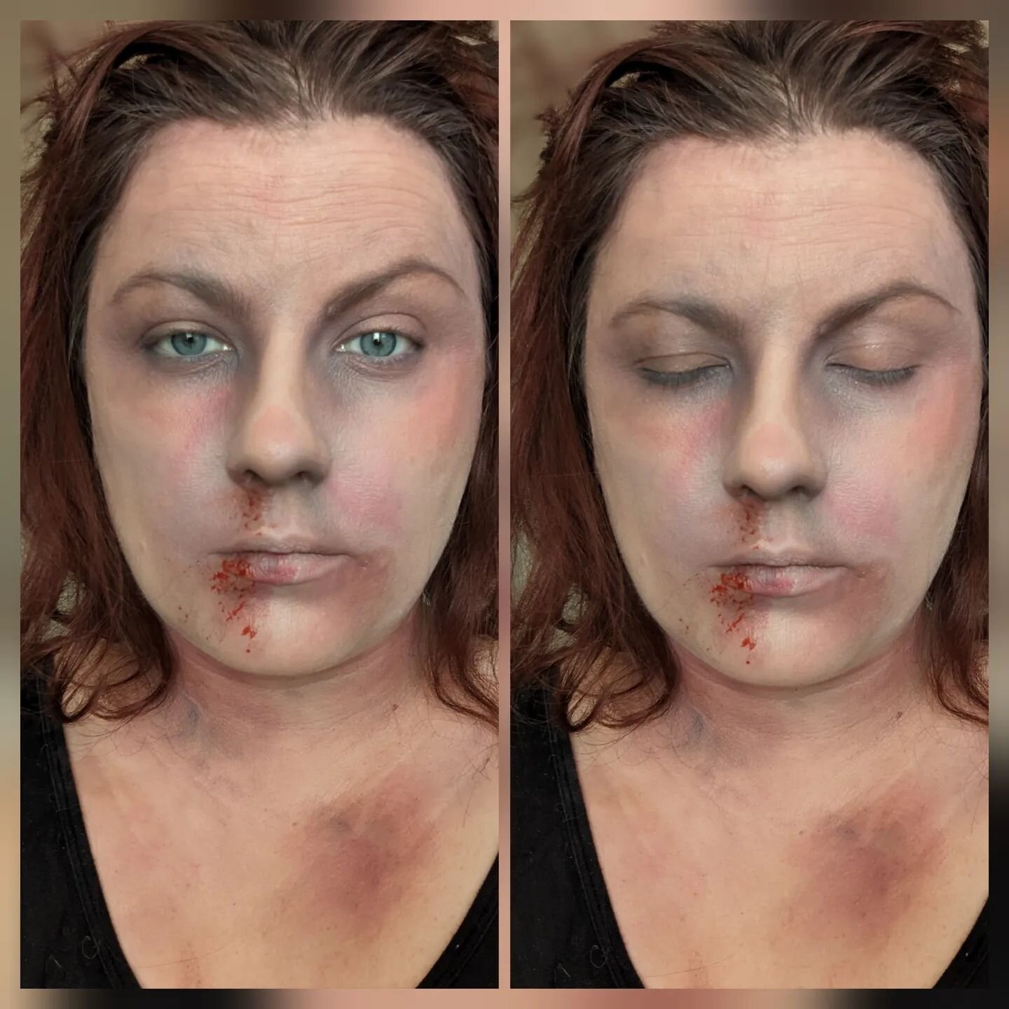*SFX Warning ⚠️*
This is all makeup. 
.
Halloween look #3 special effects
.
.
.
#happyhalloween #specialeffectsmakeup #makeupbruises #makeupartist #halloweenspecialeffectsmakeup #halloween #deadgirlmakeup #beatenupmakeup #makeup