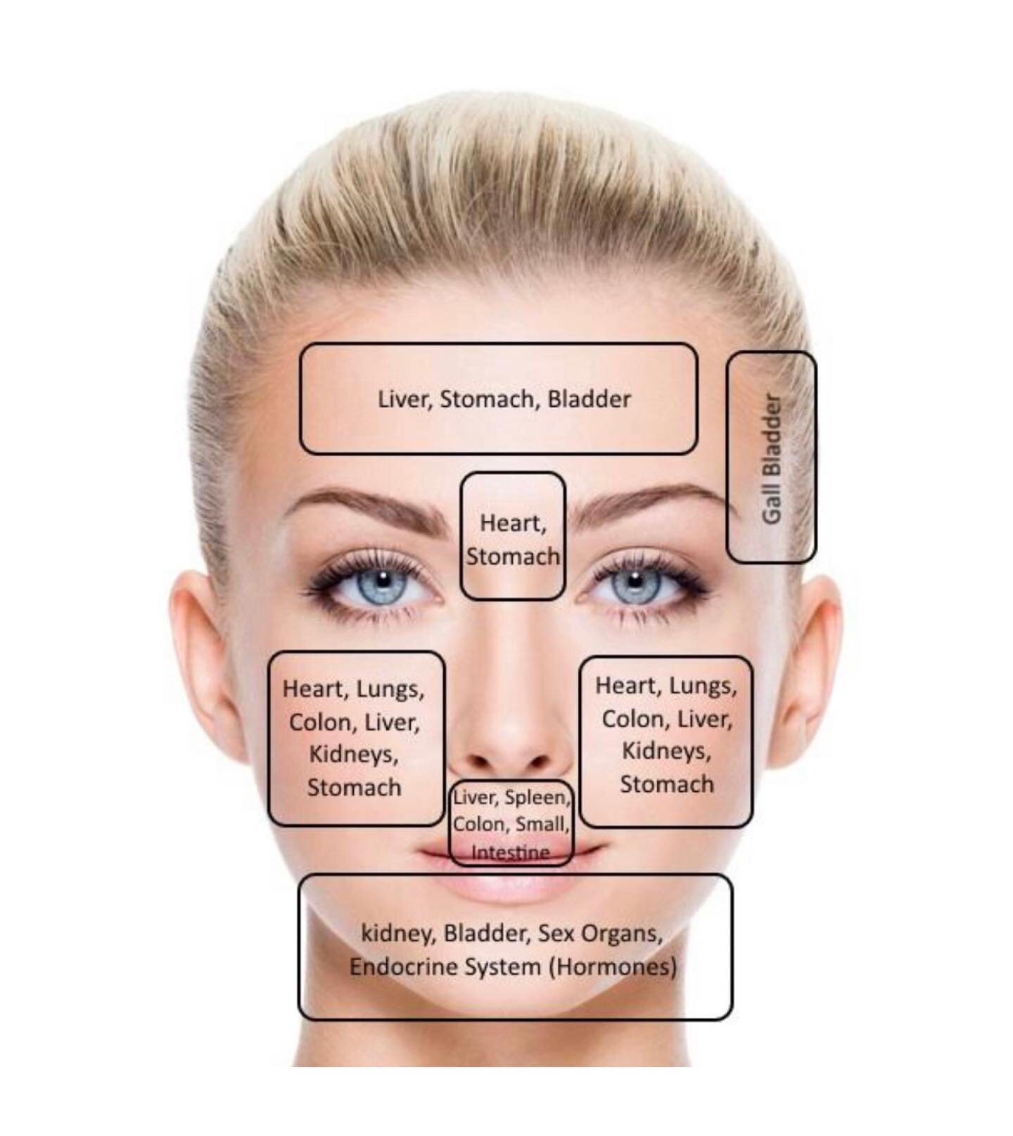 Acne is a complex skin condition &amp; reflects the processes inside our body.
The idea of the acne face map is rooted in this principle. Acne face mapping is followed in traditional Chinese medicine &amp; is based on the idea that internal factors m