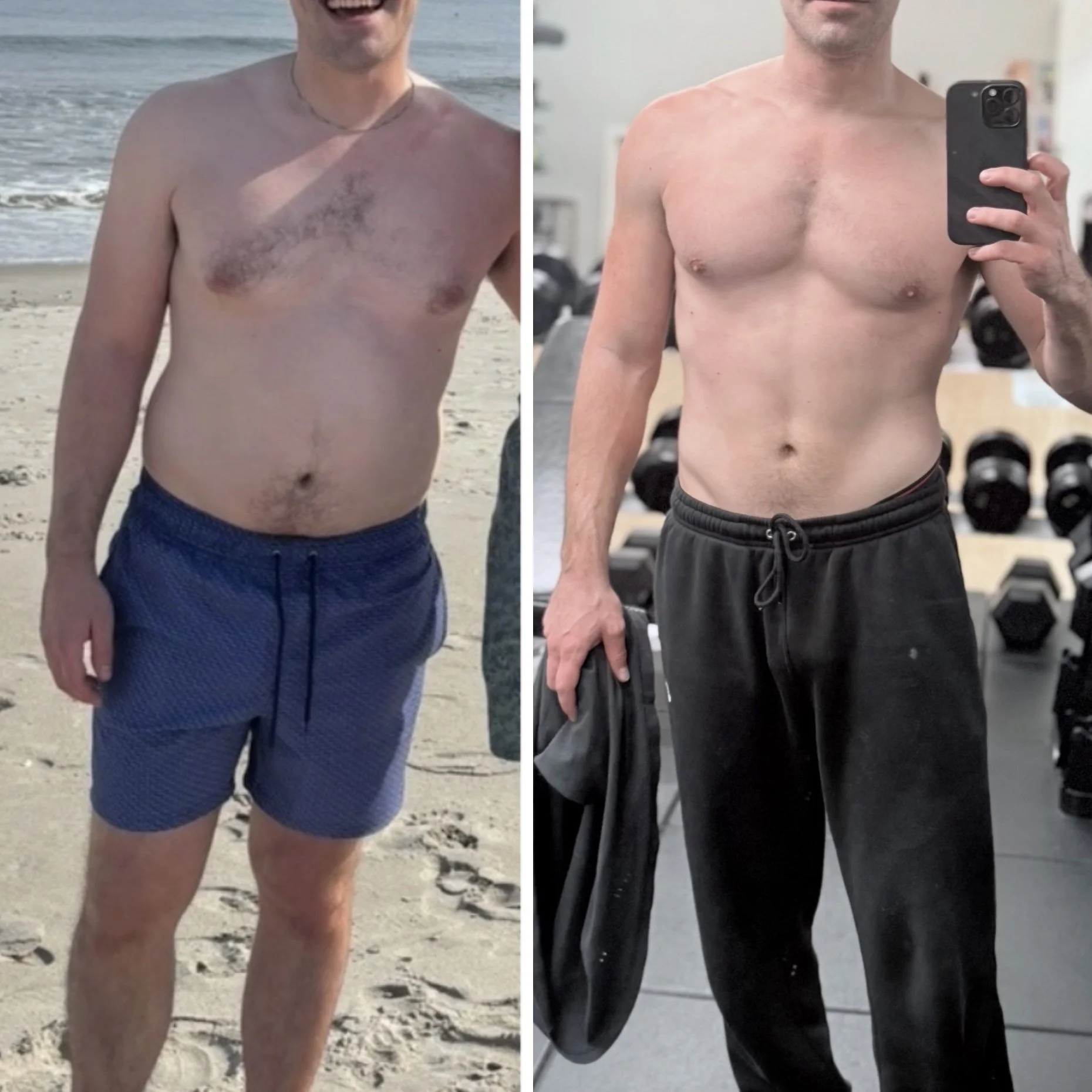 Side-by-side comparison of a shirtless man. The left photo shows him at the beach, with skin discoloration and hair on his chest. The right photo shows him in a gym, with clearer skin and no chest hair, holding a phone for a mirror selfie.