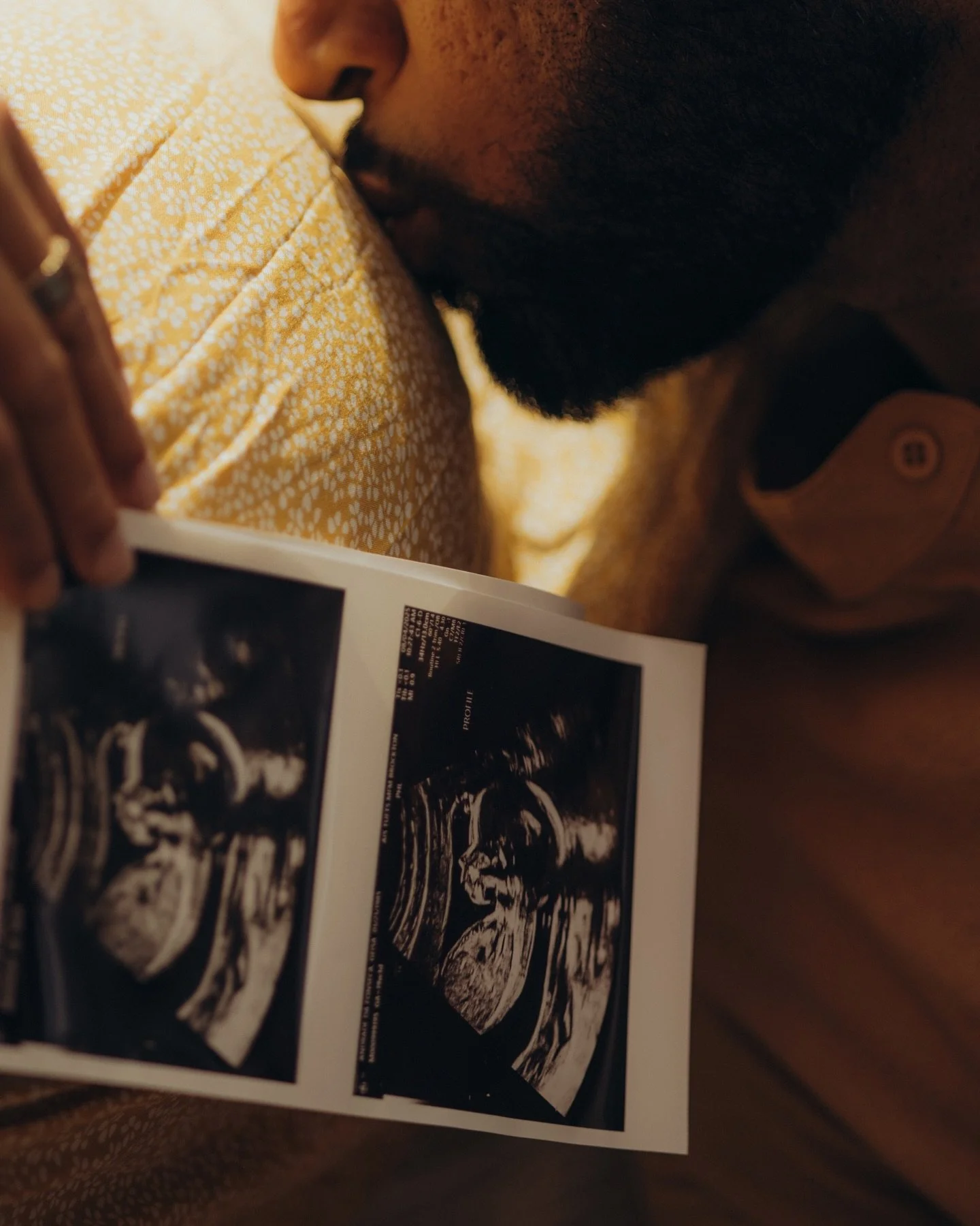 baby Nadine is coming 🪿🌼☀️💛💫
Maternity photoshoot