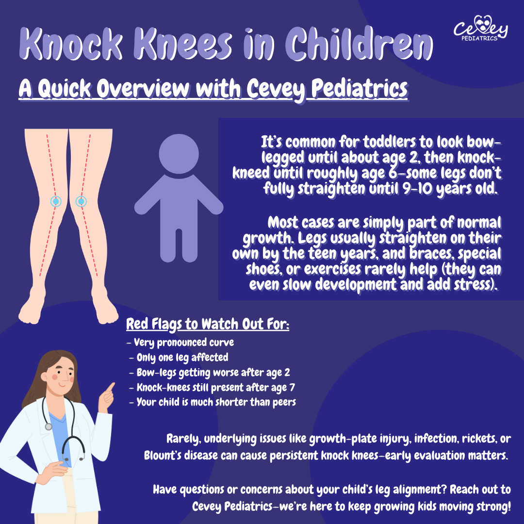 Knock Knees.png