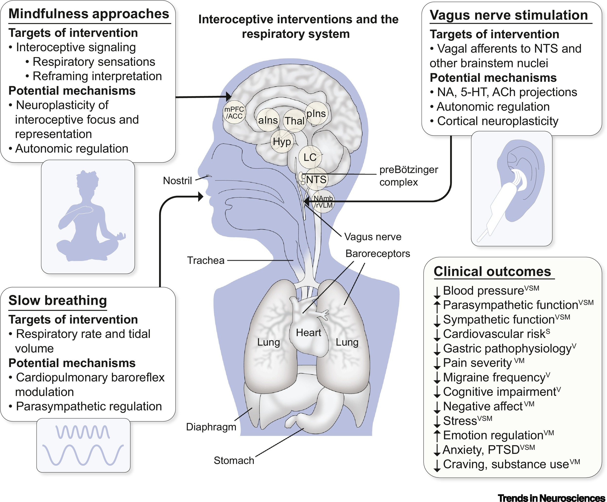 Anxiety influences interoceptive signals from the respiratory system