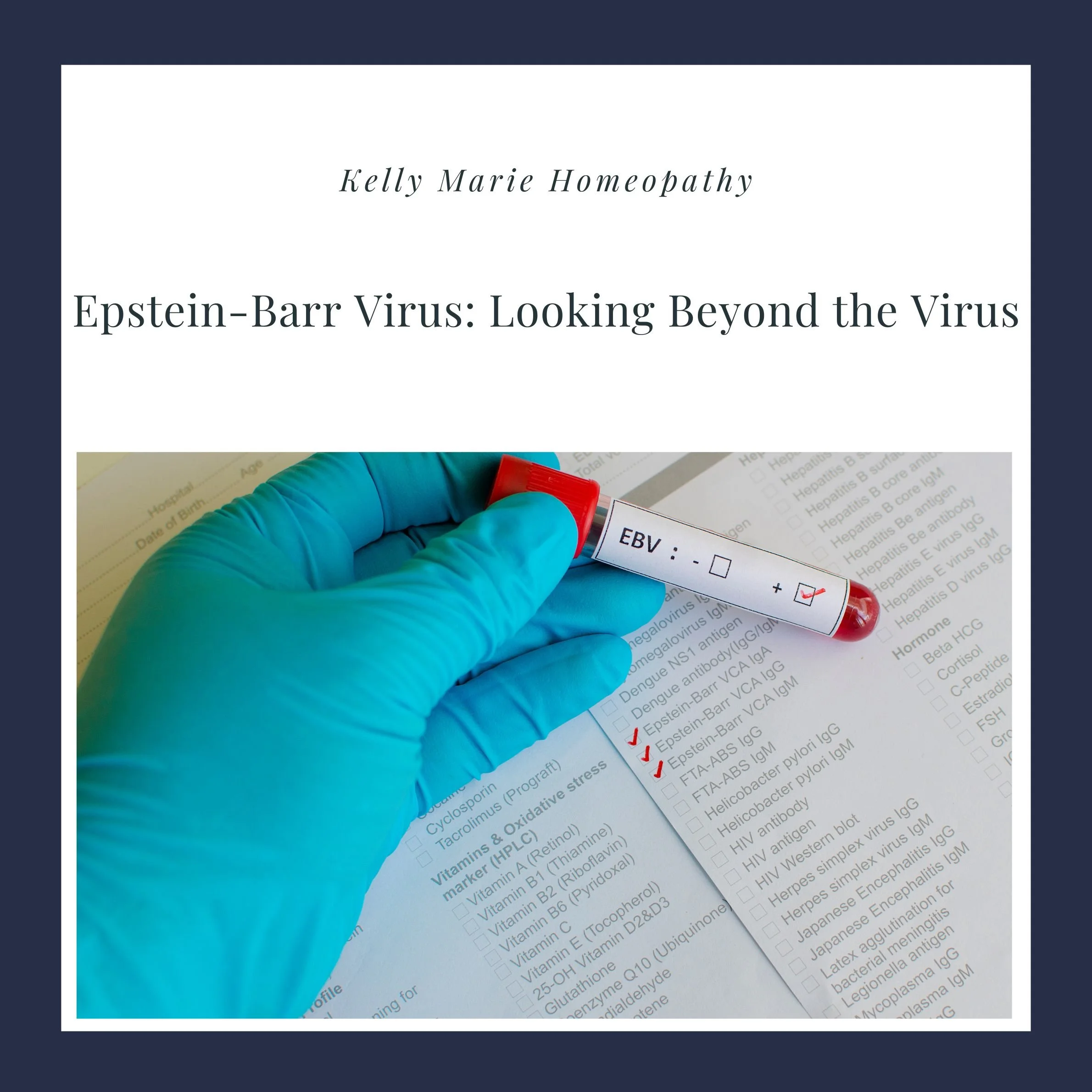 Epstein-Barr Virus: Looking Beyond the Virus