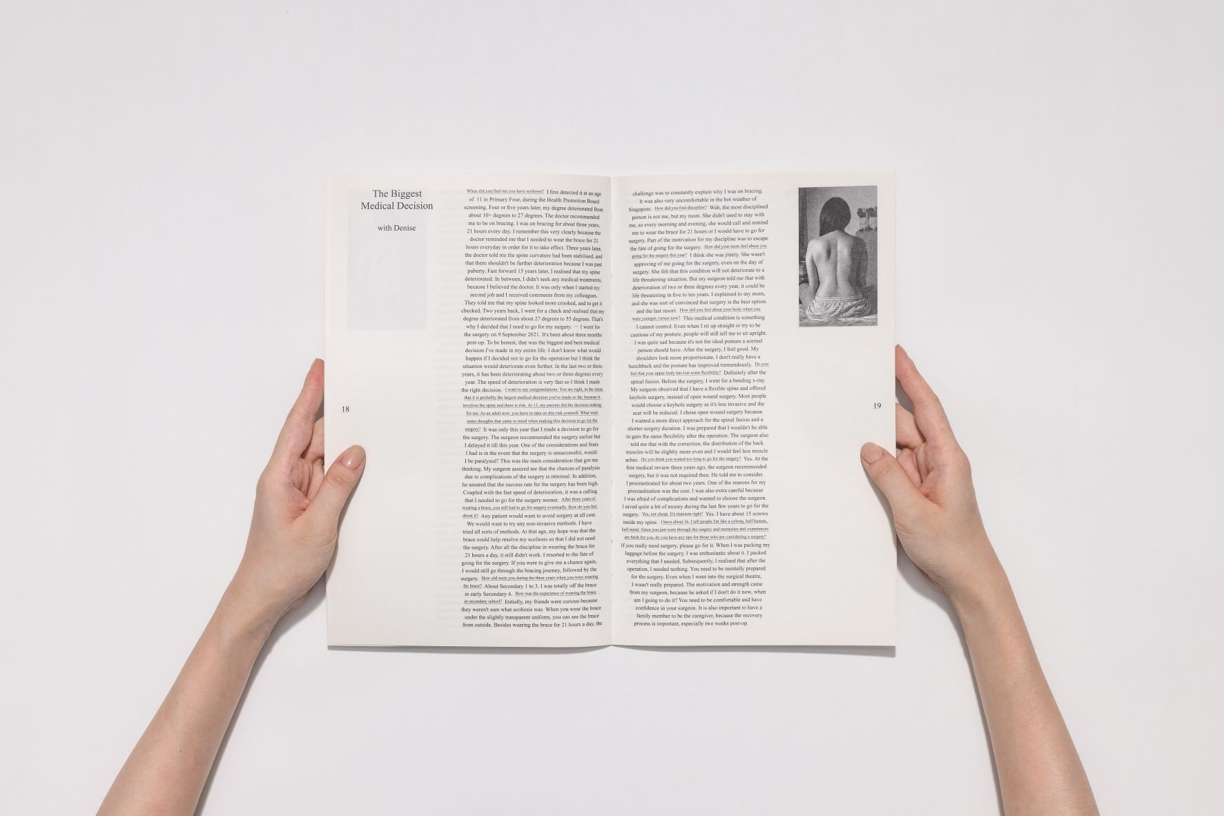  A spread from the photobook ‘rules for photographing a scoliotic patient’, published by THEBOOKSHOW and designed by Macarius Eng. Image courtesy of Macarius Eng. 