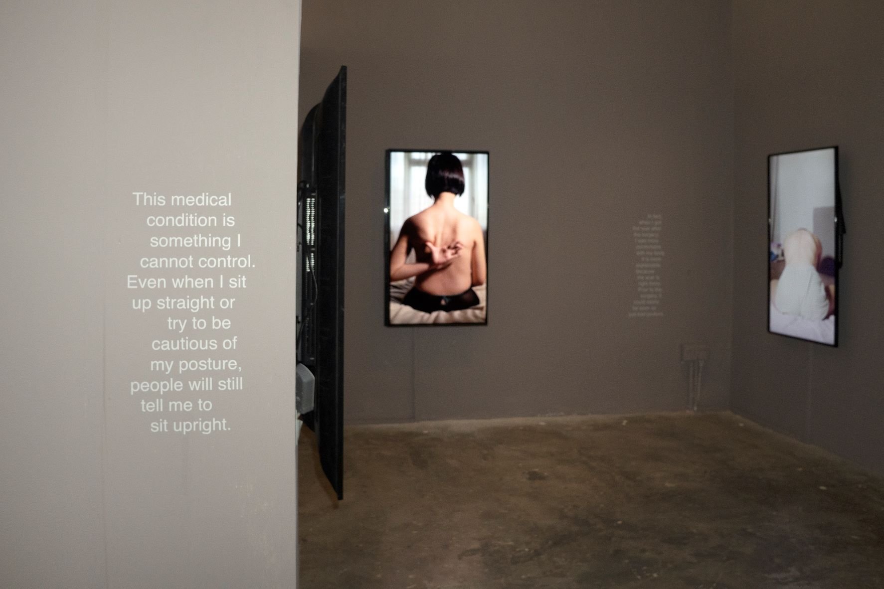  Woong Soak Teng, ‘rules for photographing a scoliotic patient’, 2022, exhibition installation view at Objectifs – Centre for Photography. Image courtesy of the artist. 
