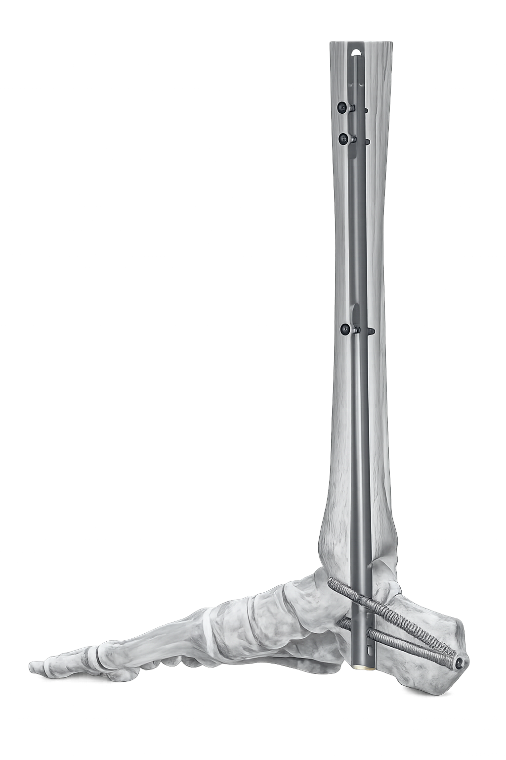 Foot & Ankle medical devices