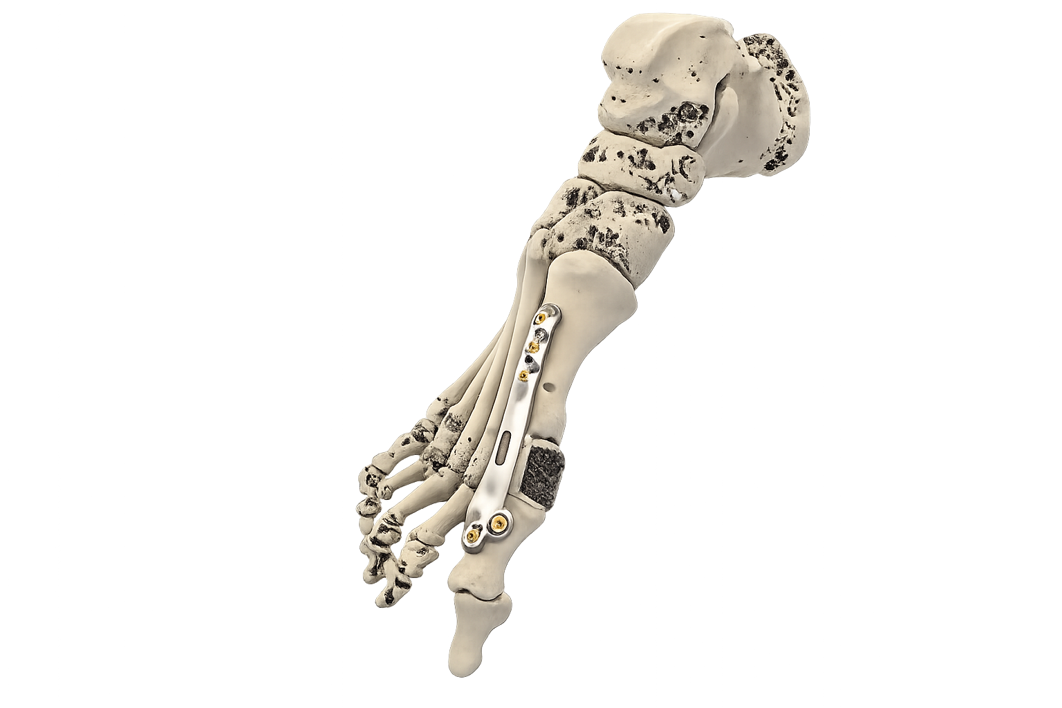 3D patient specific implants