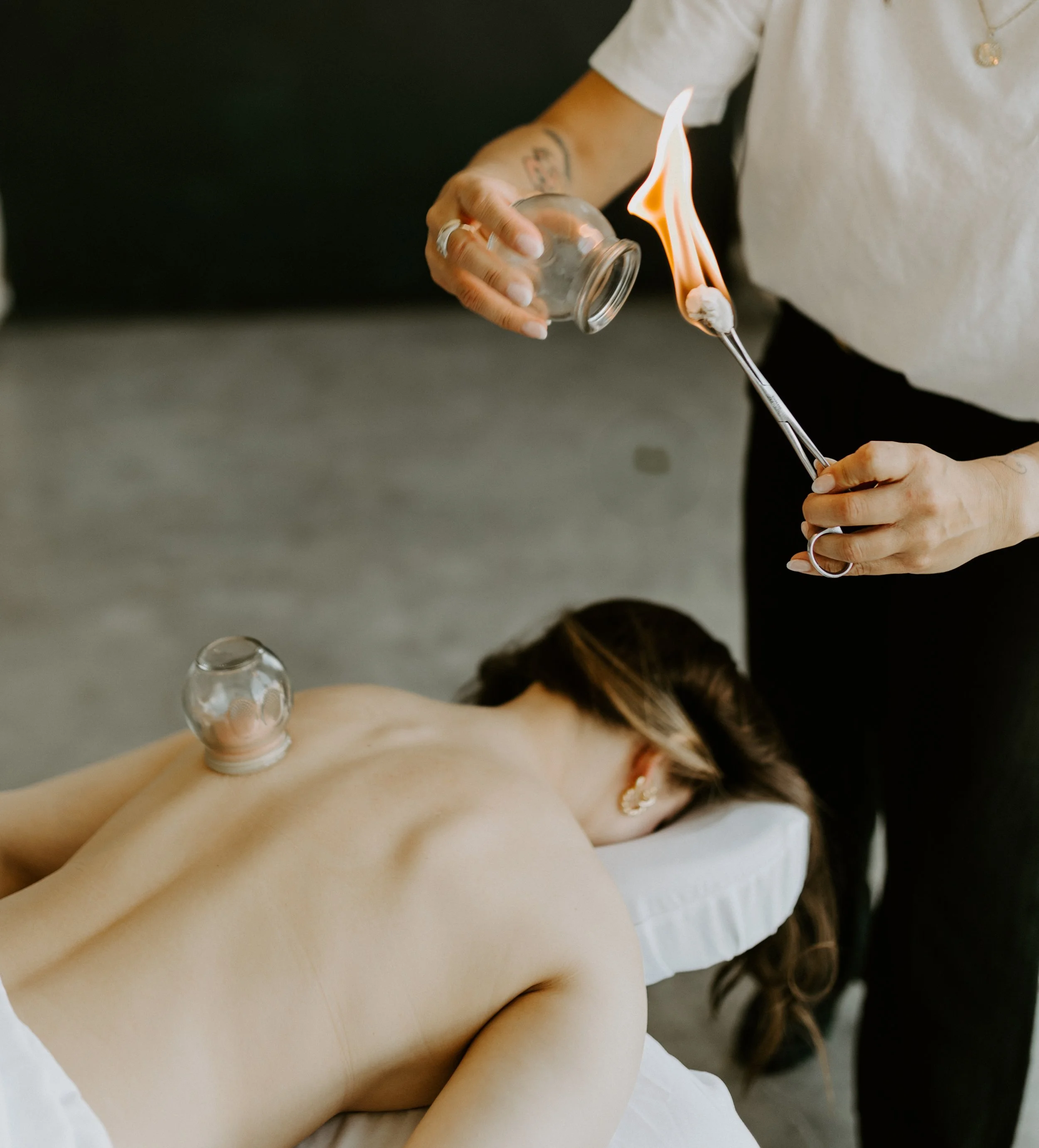 A person lying face down receiving cupping therapy with glass cups on their back, while another person is holding a lit match and a glass cup for fire cupping.